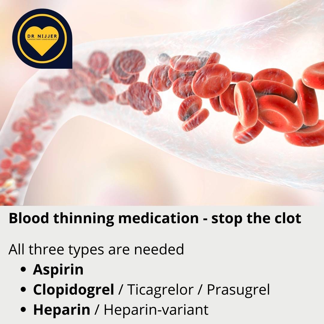 Heart Attack Expert London Cardiologist for your Heart Health